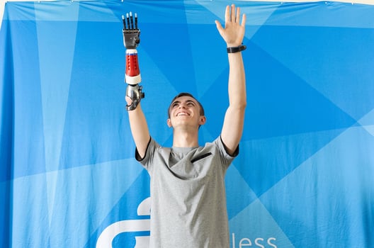 זאקרי יד תותבת, סטרטסיס, צילום: Limbitless Solutions