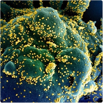Corona Virus - FreeImages